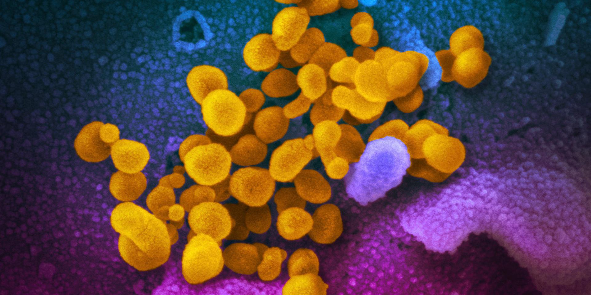 På bilden som tagits med hjälp av ett elektronmikroskop syns det nya coronaviruset sars-cov-2 (gult). Provet togs från en patient i USA. Arkivbild.