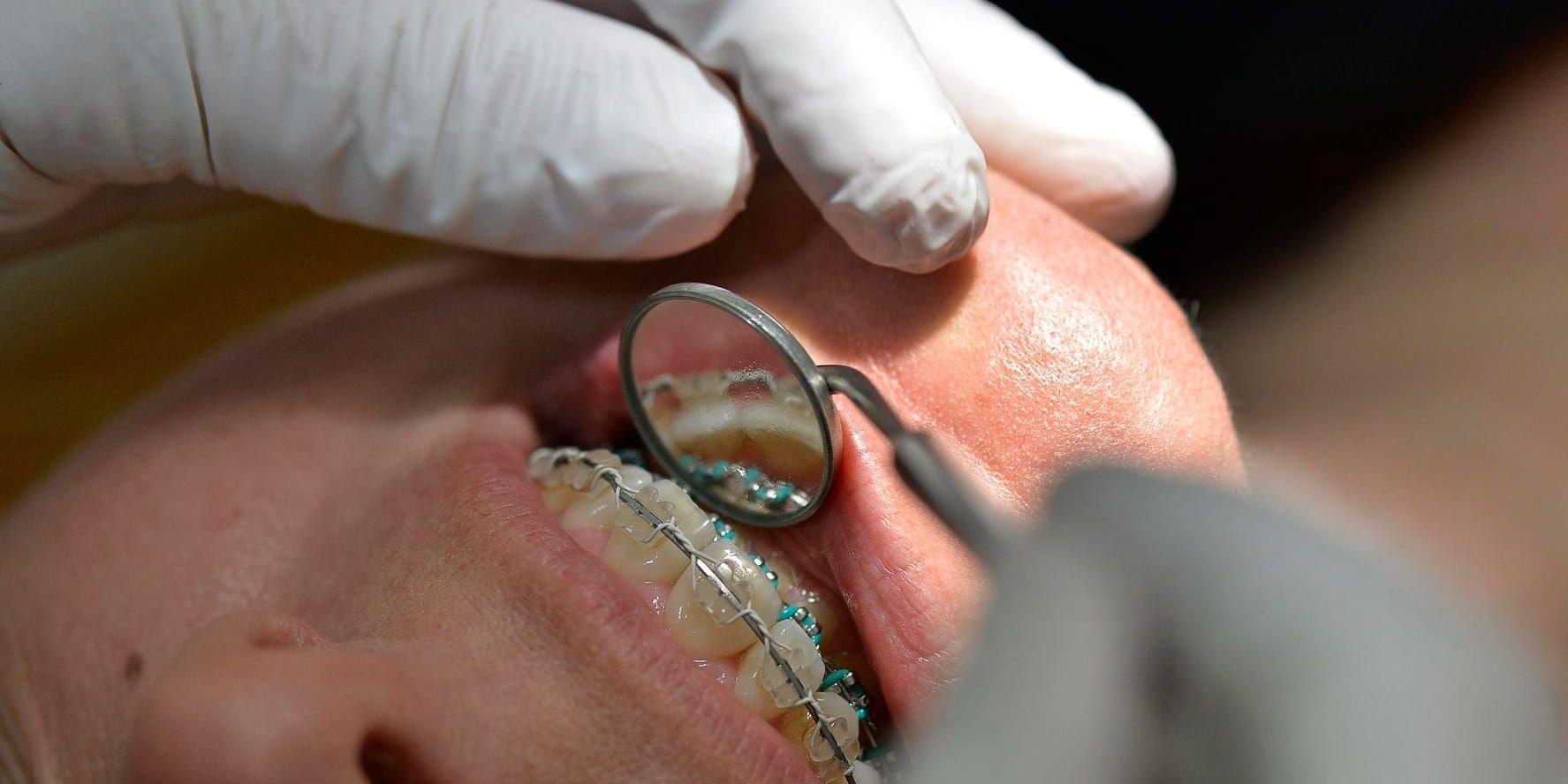 Åklagaren väljer att avgränsa utredningen mot den tandläkare i Västsverige som har anmälts för nästan 200 felbehandlingar och skador. Arkivbild.