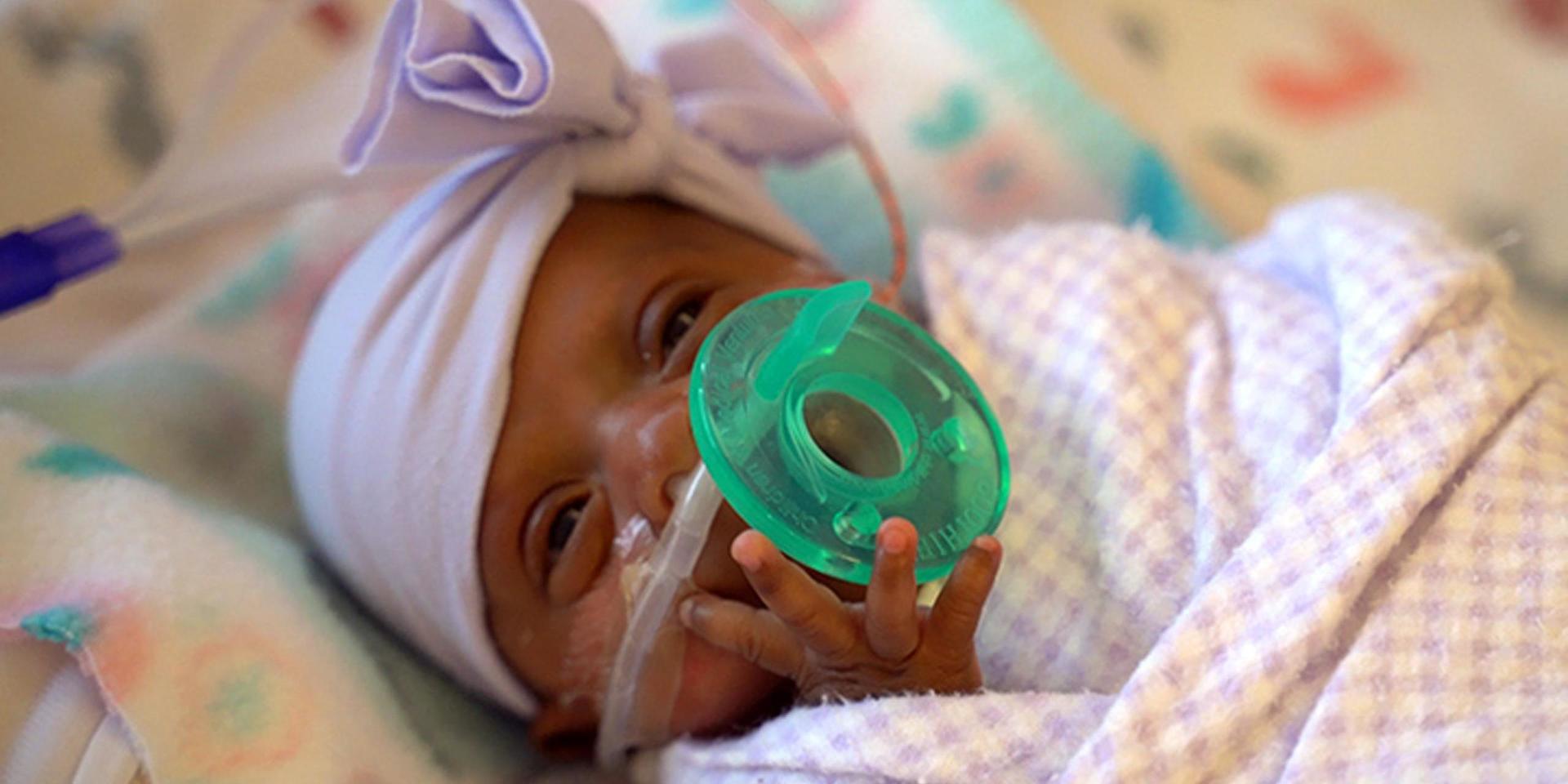 Lilla Saybie sägs vara det minsta barn i världen som överlevt. Hon vägde 245 gram vid födseln. Arkivbild.