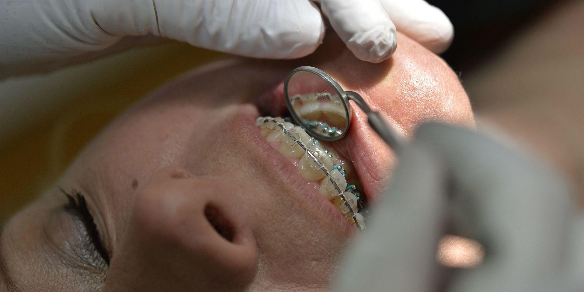 STOCKHOLM 2015-03-04 Till TT-text om tandreglering. Allt fler reglerar sina tänder. De senaste åren har statens kostnader för tandreglering ökat med 20 %. Foto: Anders Wiklund / TT / kod 10040