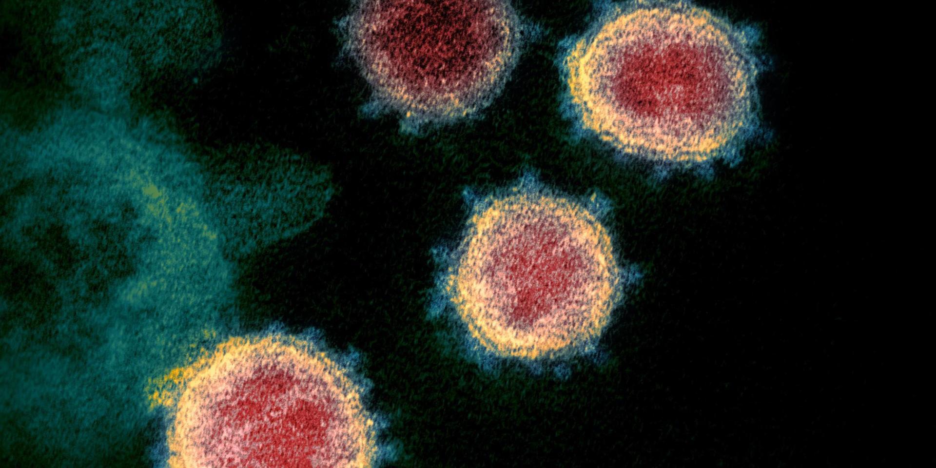 Viruset, som orsakar covid-19, fotat genom mikroskop. 